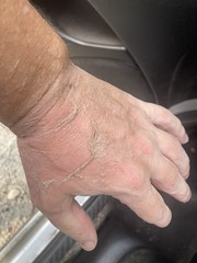 Zombie Skin Hand 