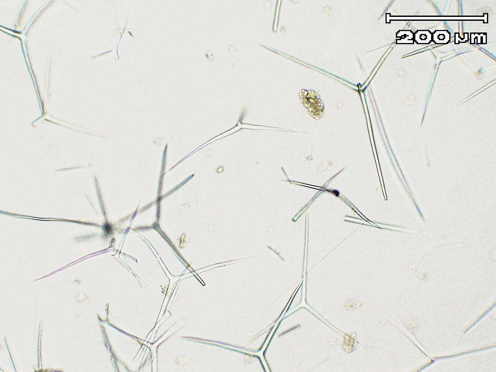 Spiculus Image Spicules Slide