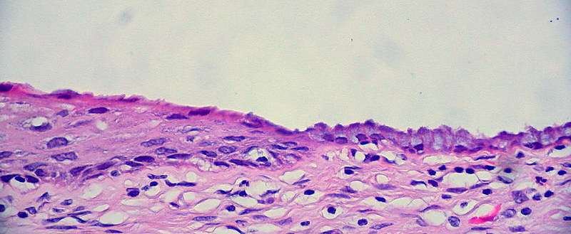 Cervix: Normal Squamocolumnar Junction