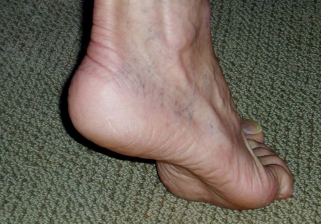 Foot - Tiptoed Foot - HeelsandFeet - Flickr
