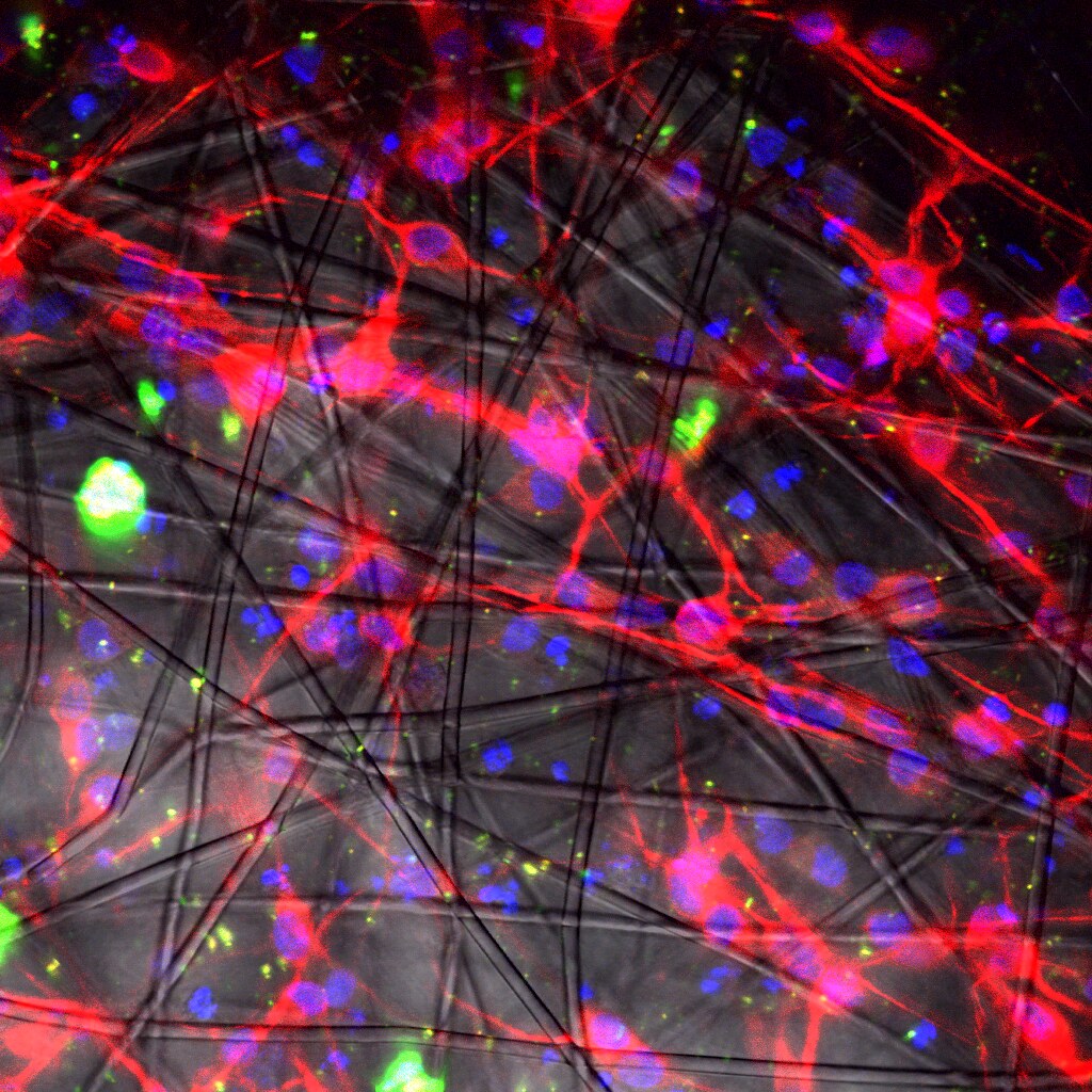 3-D technology enriches human nerve cells for transplant to brain