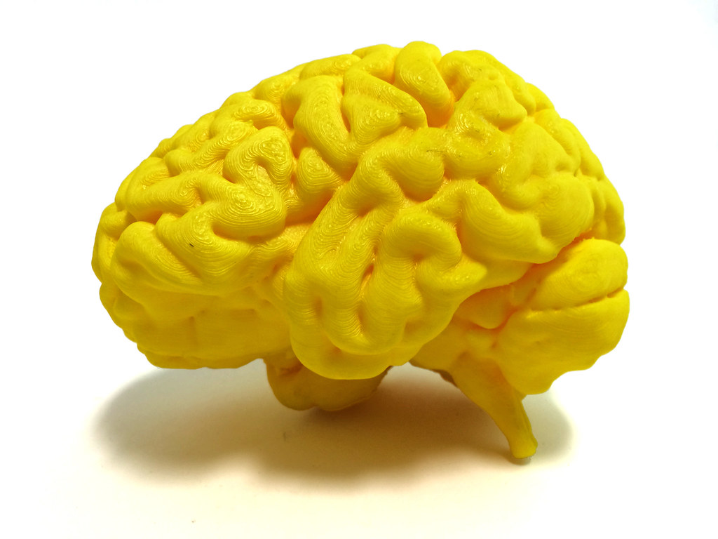 Normal Human Brain, Normal Human Brain 3dprint.nih.gov/ Cre…