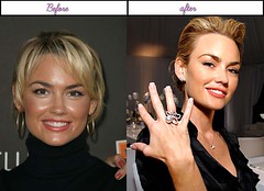 Pictures Kelly Carlson Immediately After She Gone Through Plastic Sugery In 2014