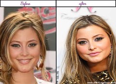 Holly Valance Received Plastic Surgery Her Just After Before Looks