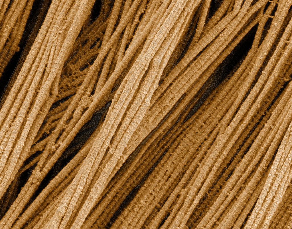 Scanning electron microscopy of collagen fibers | This image\u2026 | Flickr