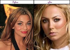 Beautiful Women Celebrities Imogen Bailey After Owning Plastic Surgery Serious Pics
