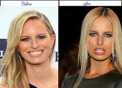 After Before Pictures Of Karolina Kurkova When She Had Her Plastic Sugery In Latest Yr
