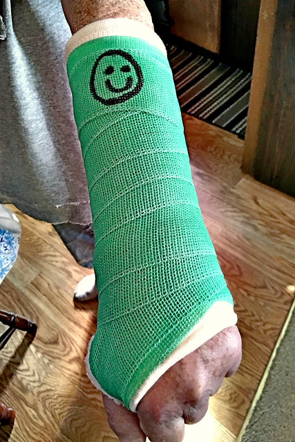 Another Cast