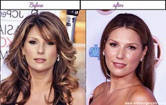 Pics Of Daisy Fuentes Soon After Prior To Operation