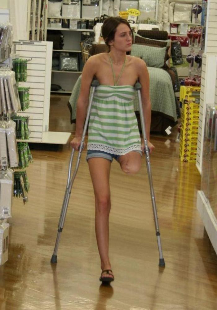 LUCIA AMPUTEE LEG CRUTCHES AXILLARY | LUCIA AMPUTEE THE LEFT… | Flickr