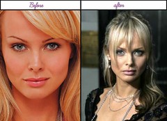 After Plastic Surgery Pictures Of Izabella Scorupco She'S Really Charmful Soon After Plastic Beauty Surgical Procedure