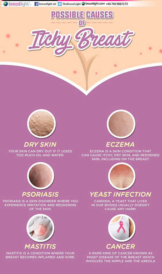 Got itchy breasts? Maybe one - Ahvia Beauty and Wellness