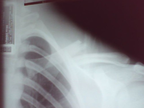 Xray | by Geoff Lysaght