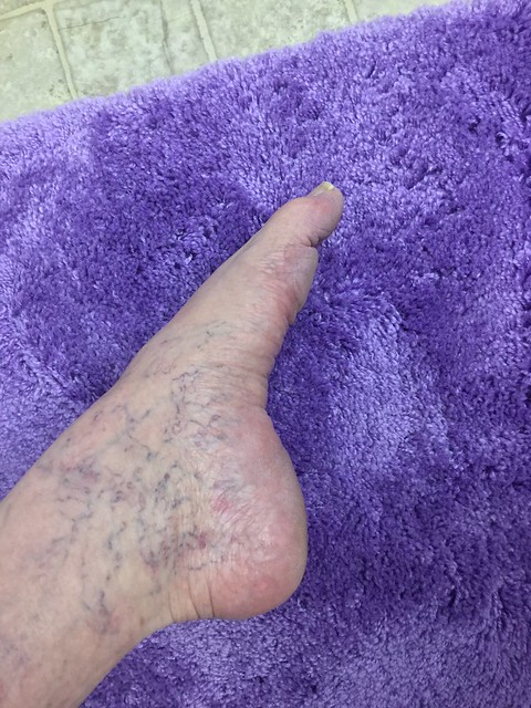 Foot veins