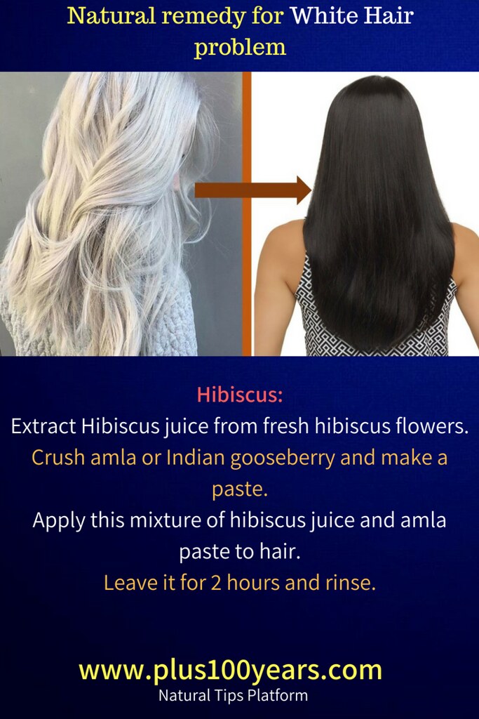 natural remedy for white hair | White hair in teens is the b… | Flickr