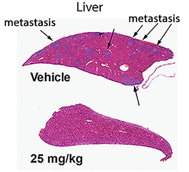 Liver Cancer in Mouse Model