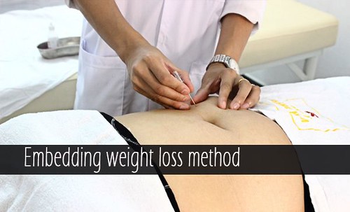 embedding-weight-loss | by weightlosetreatment