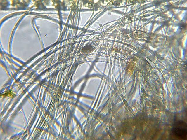 Threadworm (Strongyloides stercoralis)