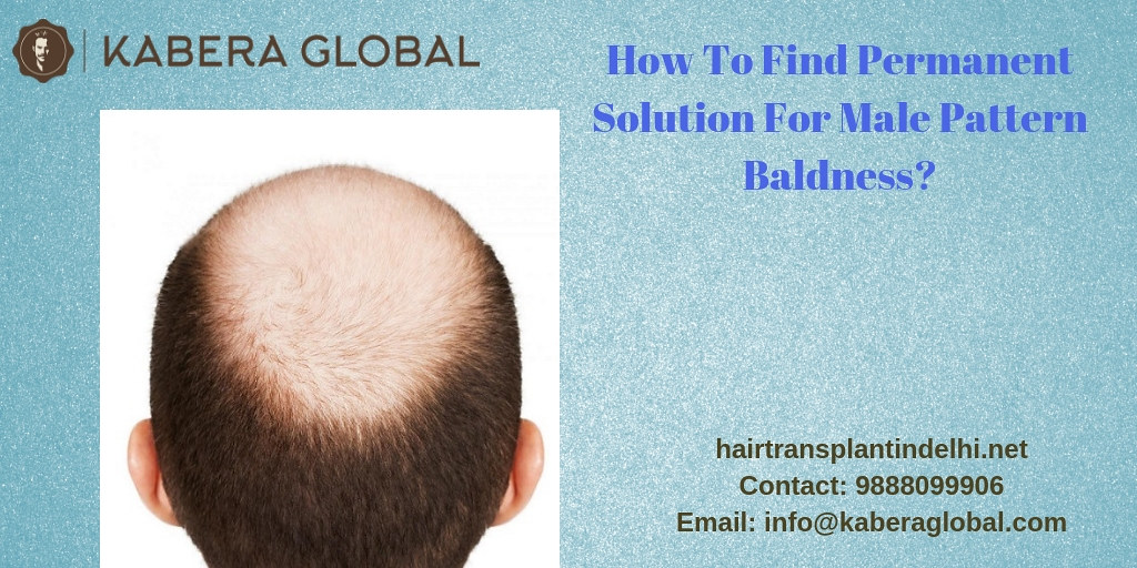 Permanent Baldness Solution|Hair Transplant Delhi | Are you … | Flickr