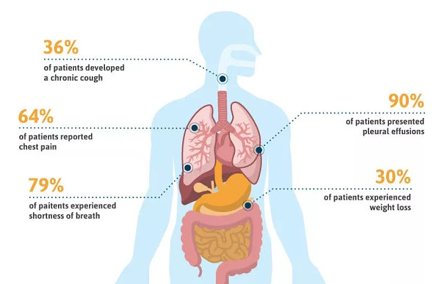 end stages of pleural mesothelioma