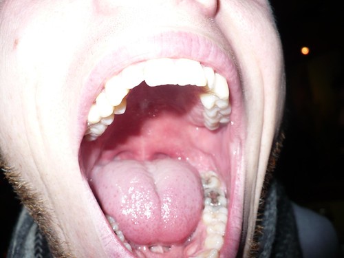 Mouth Holes
