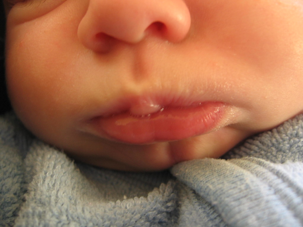 Cutest baby dimple chin ever! (225/365) | Today was the firs… | Flickr
