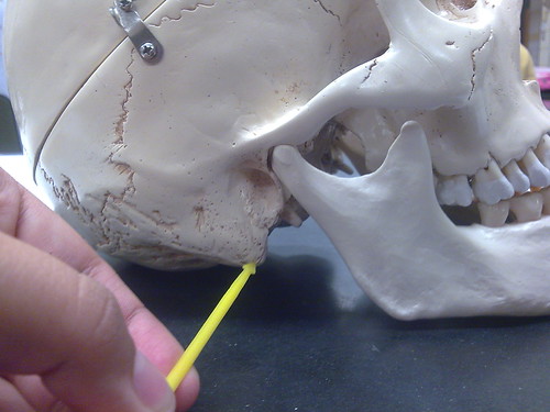 Mastoid Process | by minimarnett