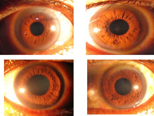 mata | mata adalah jendela hati. Iridology, metode diagnosis… | Flickr