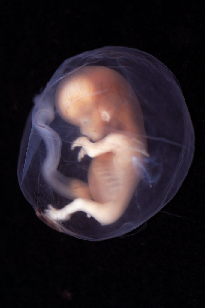 Embryo week 9-10