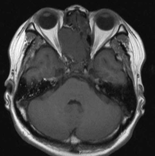752316_mri_2 | by allentube211