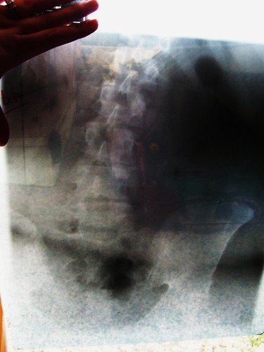 My Spine | by Moo27