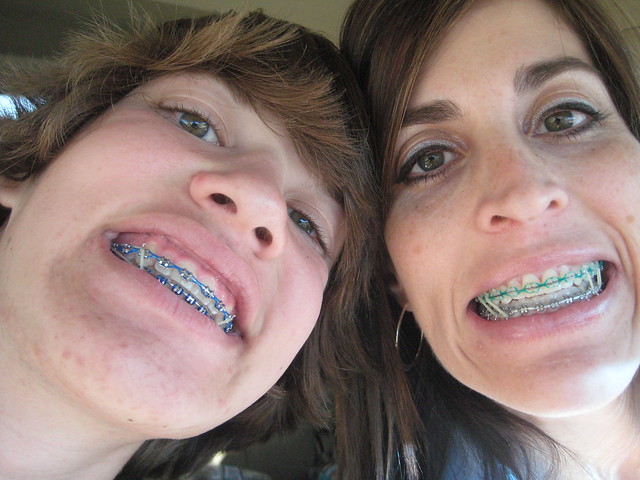 And then there's us Sillies - modeling our braces