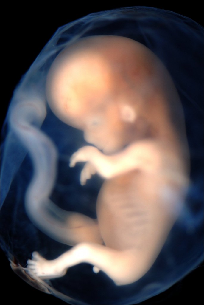 Picture 13 Week Fetus