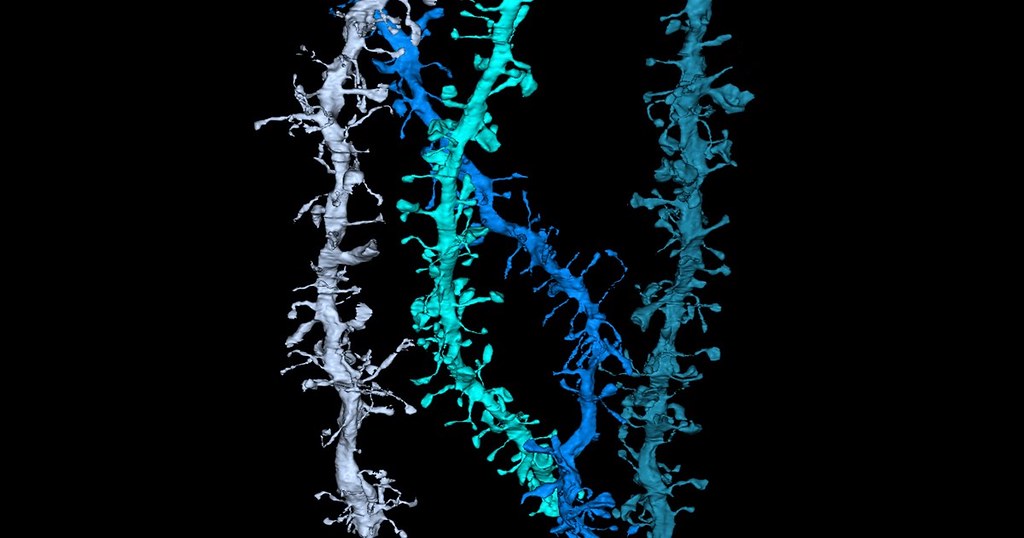 Colorized 3D reconstruction of dendrites