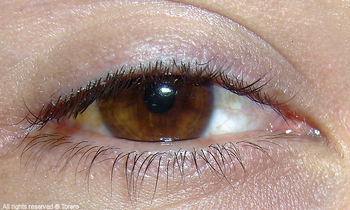 Mi ojo agotado.- | Pueden ver en mi ojo el resultado de un f… | Flickr