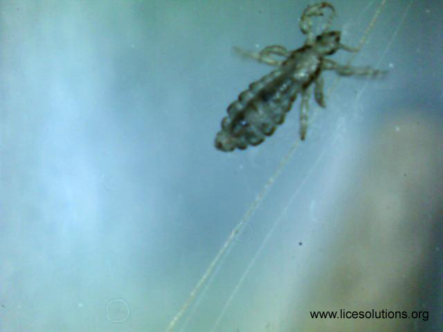 Head Lice - Adult Louse with Claws