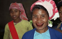 Tribal woman with betel stained teeth and plants in her metal earrings; Menghum, Xishuangbanna, Yunnan, China