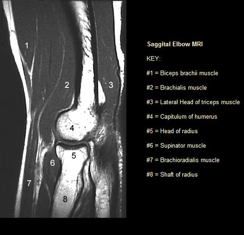 Mri Protocols Elbow Mri Anatomy