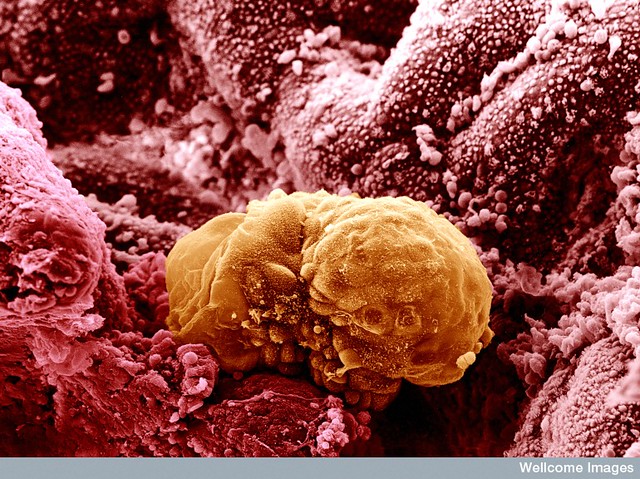 B0003308 6 day old human embryo implanting - coloured