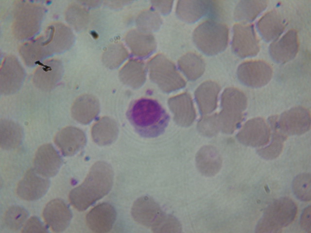 Plasmócito, plasma cell