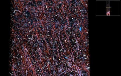 Image Scanning Microscopy Array Array Tomography Microscopy | Imaris Snapshot Microscopy ima… | Flickr