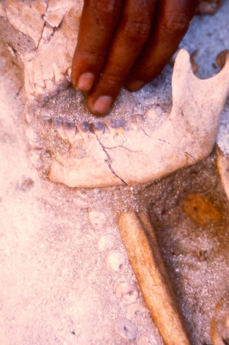 This detail of a burial shows a row of spondylus beads running from below the jawbone and down across the collar bone.  Also evident here are the blackened teeth caused by chewing of betelnut.  Ypao excavation, 1979.

Judy Flores