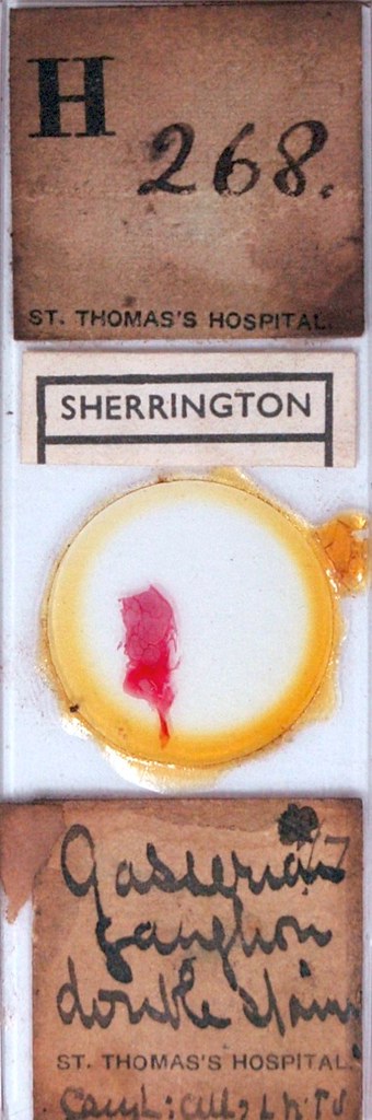 Sherrington's Box Drawer 15, Row 1, Slide 9