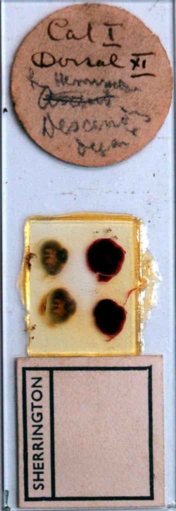 Sherrington's Box Drawer 12, Row 1, Slide 2