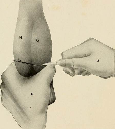 Image from page 103 of "Animal castration : a book for the use of stud...