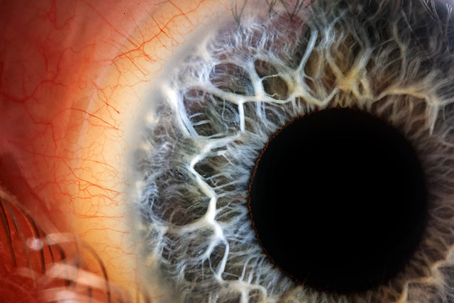 Blue Iris, Human Eye, 25 Years old, Male