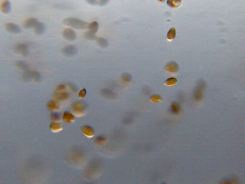 Dinoflagellate (Ostreopsis ovata)