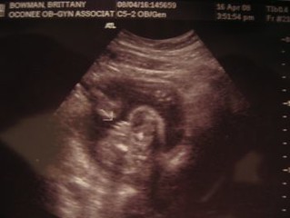 We're having a baby GIRL!! | On April 16th 2008 we went for … | Flickr