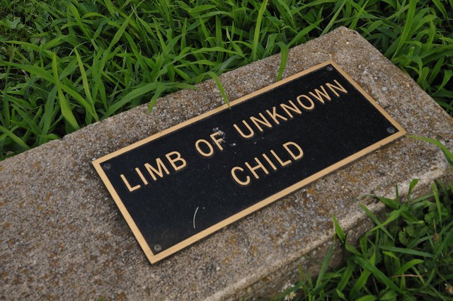 Limb of Unknown Child