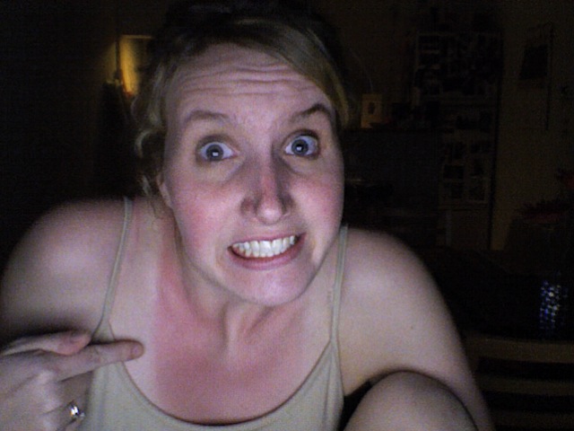 Oops! - this is the sunburn i got from the picnic today! hah… - Flickr